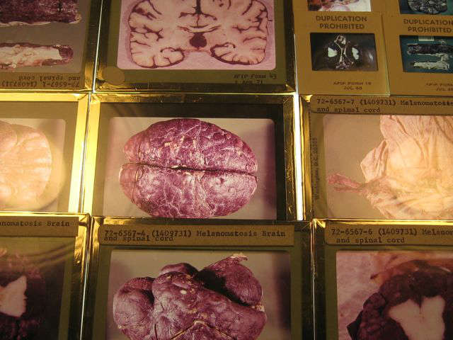 Photo slides of pathology items
brains and the like!