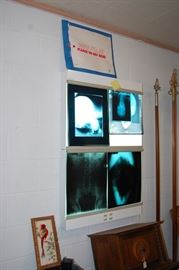 X-ray Viewing Machine