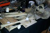 Medical School Skeleton pieces
