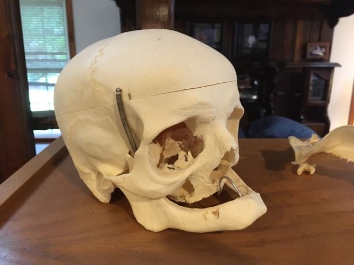Geriatric Human Skull, Female