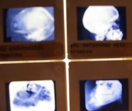  teaching medical x-ray slides Army?