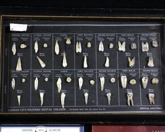 Antique Dental Tooth Pulling Tools, Books On Old Dental Instruments And Framed Teaching Display Of Tooth Anatomy