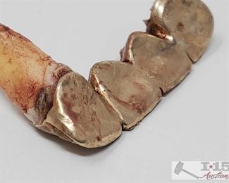 120: 14k Gold Teeth, 5.9g
Weighs approx 5.9g 
J1