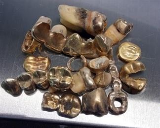 Straight from the dentist Vtg gold fillings and caps