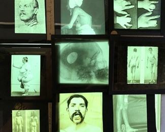 Collection of 45 Late 19th Century Glass Medical Slides - Lot 46a