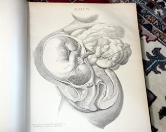Elephant Folio Size Book Gynaecology & Obstetrics 1881