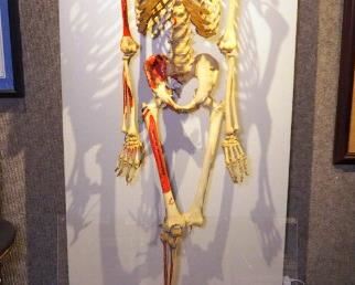 Vintage Authentic Human Bone Teaching Skeleton, Circa 1940, Display Fixture Included, 78" x 31" x 21"