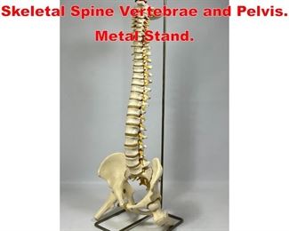 Lot 162 Medical School Model Skeletal Spine Vertebrae and Pelvis. Metal Stand. 
