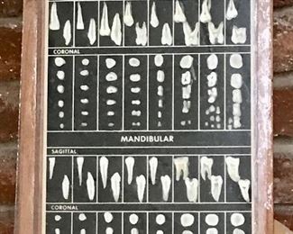 Internal Anatomy of the Teeth Display Case 