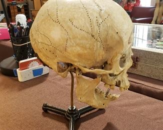 Antique medical human skull