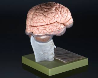 SOMSO German Medical 15 Part Dissectible Brain Model Zerlegbares Gehirnmodell  BS25	9.75x7x7.25in	124002