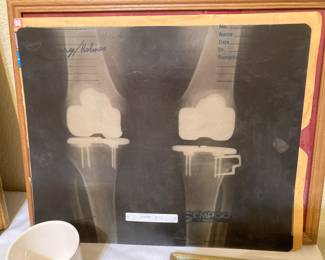 Holub's knee x-rays--he had eleven knee surgeries as an active player
