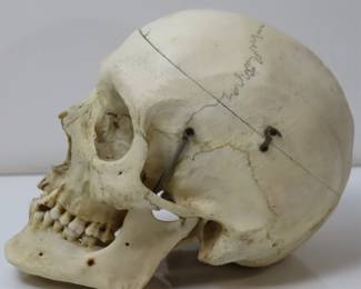 MEDICAL SKULL