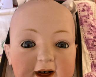 J D Kestner  18 - has a hairline base of neck in back