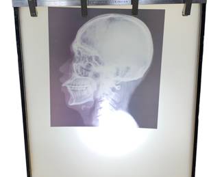 Vintage GE X-Ray Corporation Circline Illuminator Medical X-Ray machine 