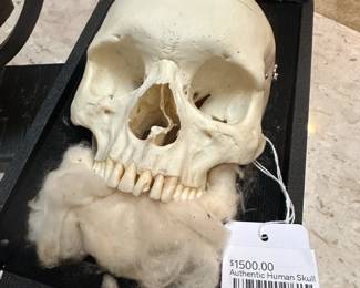 Authentic Human Skull 