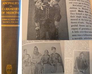 Anomalies and Curiosities of Medicine