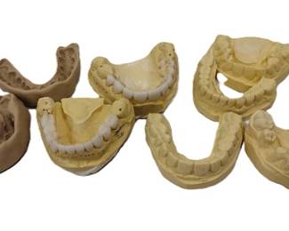 VINTAGE DENTURE MOLDS - PLASTER AND WAX
