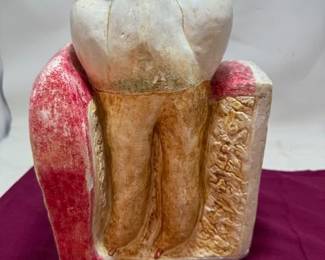 Tooth Model