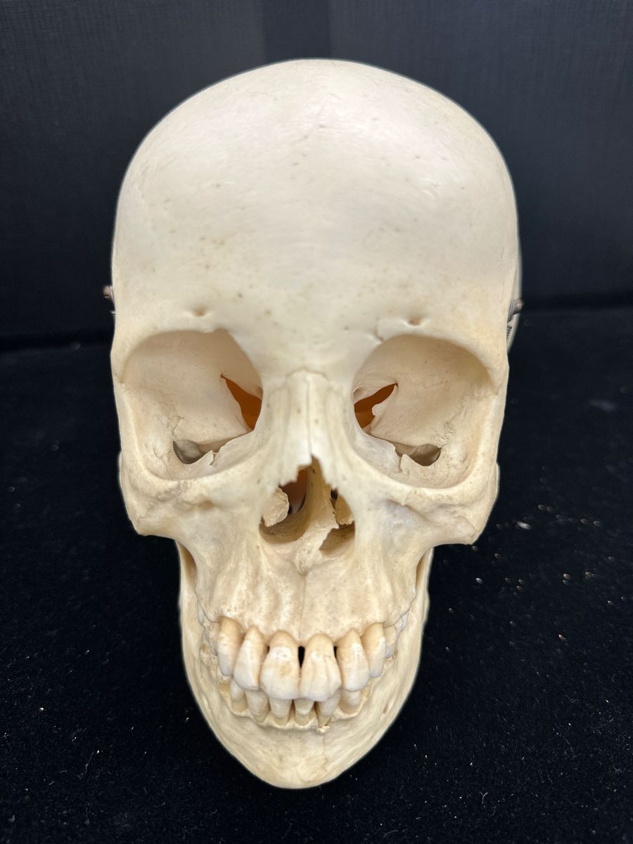 Highest and best offer on antique human skull no later than 4 o'clock Saturday, September 27.
