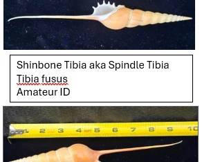 Shinbone Tibia 