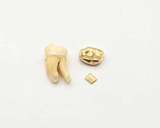 712 14k Gold Cap Tooth, 1.6g