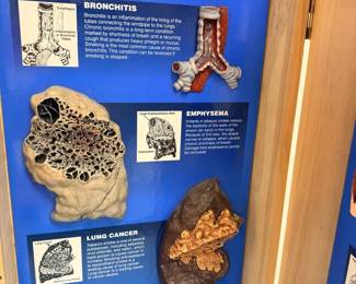 Consequences Of Smoking 3D Display