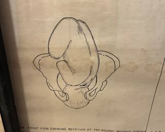 Set of 3 vintage prints depicting the onset of labor