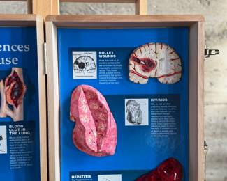 Wooden display case by Health Edco/WRS, containing educational models on the consequences of drug abuse. Case includes realistic anatomical representations of organ damage, such as brain infection, heart infection, vein damage, and birth defects. Accompanied by a ‘Substance Abuse Identification Guide’ and foam padding for storage. Case is equipped with clasps and a black handle. Exterior shows scratches and wear. Measures (closed), 27.75” H x 14” W.