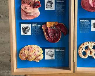 Wooden display case by Health Edco/WRS, containing educational models on the consequences of drug abuse. Case includes realistic anatomical representations of organ damage, such as brain infection, heart infection, vein damage, and birth defects. Accompanied by a ‘Substance Abuse Identification Guide’ and foam padding for storage. Case is equipped with clasps and a black handle. Exterior shows scratches and wear. Measures (closed), 27.75” H x 14” W.