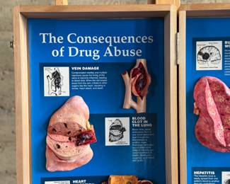 Wooden display case by Health Edco/WRS, containing educational models on the consequences of drug abuse. Case includes realistic anatomical representations of organ damage, such as brain infection, heart infection, vein damage, and birth defects. Accompanied by a ‘Substance Abuse Identification Guide’ and foam padding for storage. Case is equipped with clasps and a black handle. Exterior shows scratches and wear. Measures (closed), 27.75” H x 14” W.