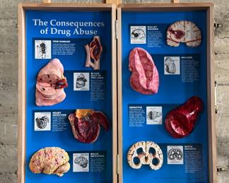Wooden display case by Health Edco/WRS, containing educational models on the consequences of drug abuse. Case includes realistic anatomical representations of organ damage, such as brain infection, heart infection, vein damage, and birth defects. Accompanied by a ‘Substance Abuse Identification Guide’ and foam padding for storage. Case is equipped with clasps and a black handle. Exterior shows scratches and wear. Measures (closed), 27.75” H x 14” W.