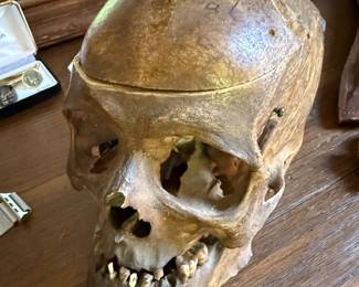Rare Real Medical School Human Skull