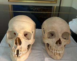 1970's Real Human Dental Teaching Skulls - 2