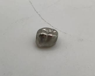 Presumed Silver Tooth Cap