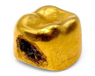 22k Gold Tooth 2g Total