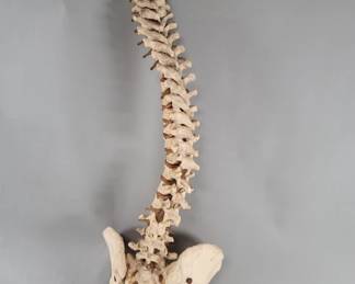 Lot 557  Composite human anatomical spine model