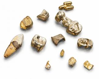 26 VintageDentalGoldSilverScrapCollection