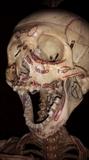 Close up off Medical School skeleton-really cool and in very good condition on stand.